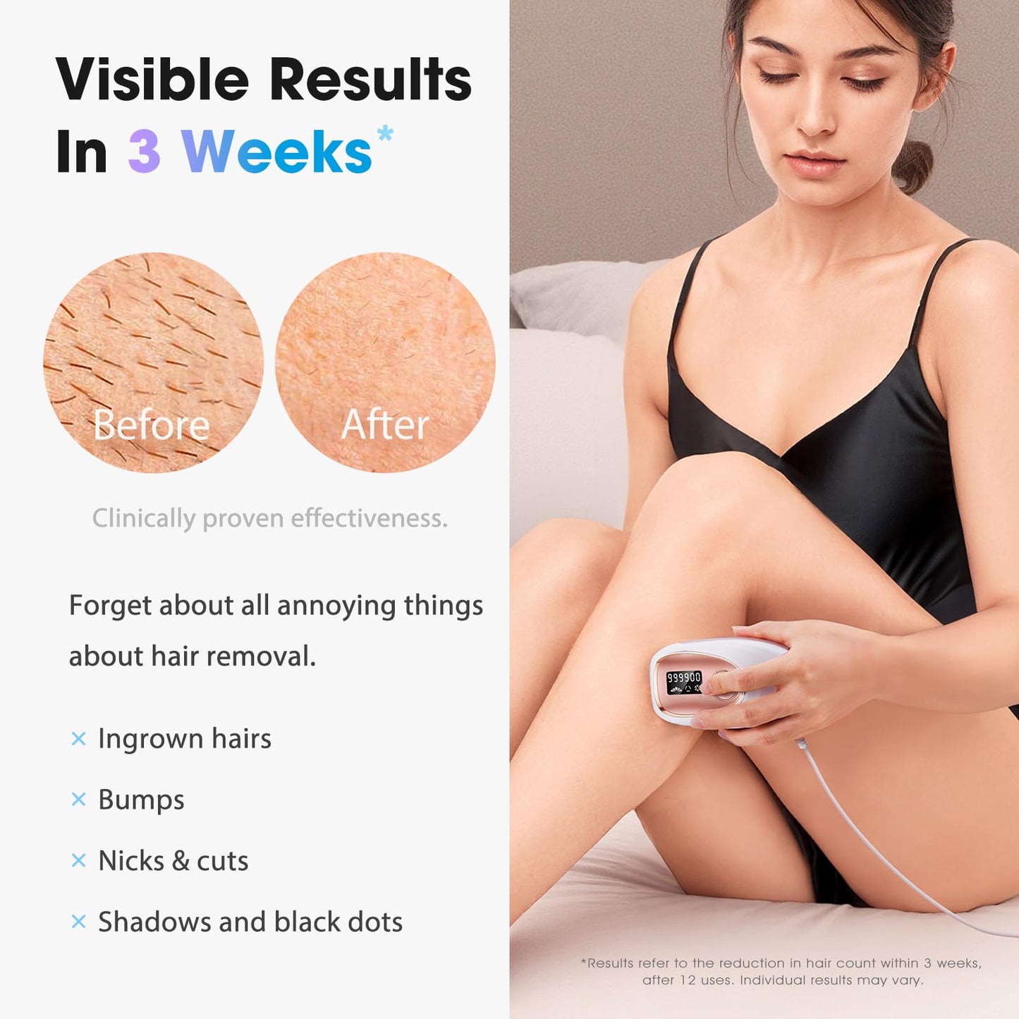 Oreeth Laser Hair Removal Device, at-Home IPL Hair Removal for Women & Men - Safe 45°F Ice-Cooling Contact for Painless & Long-Lasting Results, 86% Hair Reduction in 3 Weeks for Full Body, Gold/White