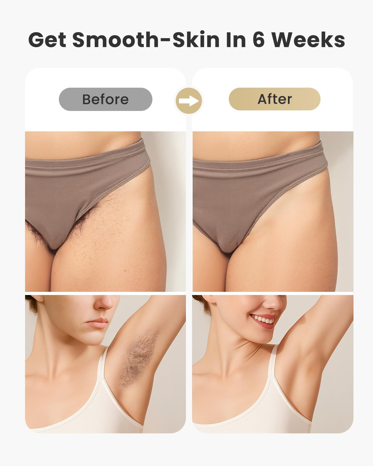 Laser Hair Removal for Women and Men - 5.2 cm² Contact Nearly Painless, Powerful Long-Lasting IPL Hair Removal at-home, Effective in 14 Days with Ultra-fast Light Emission for Whole Body Use