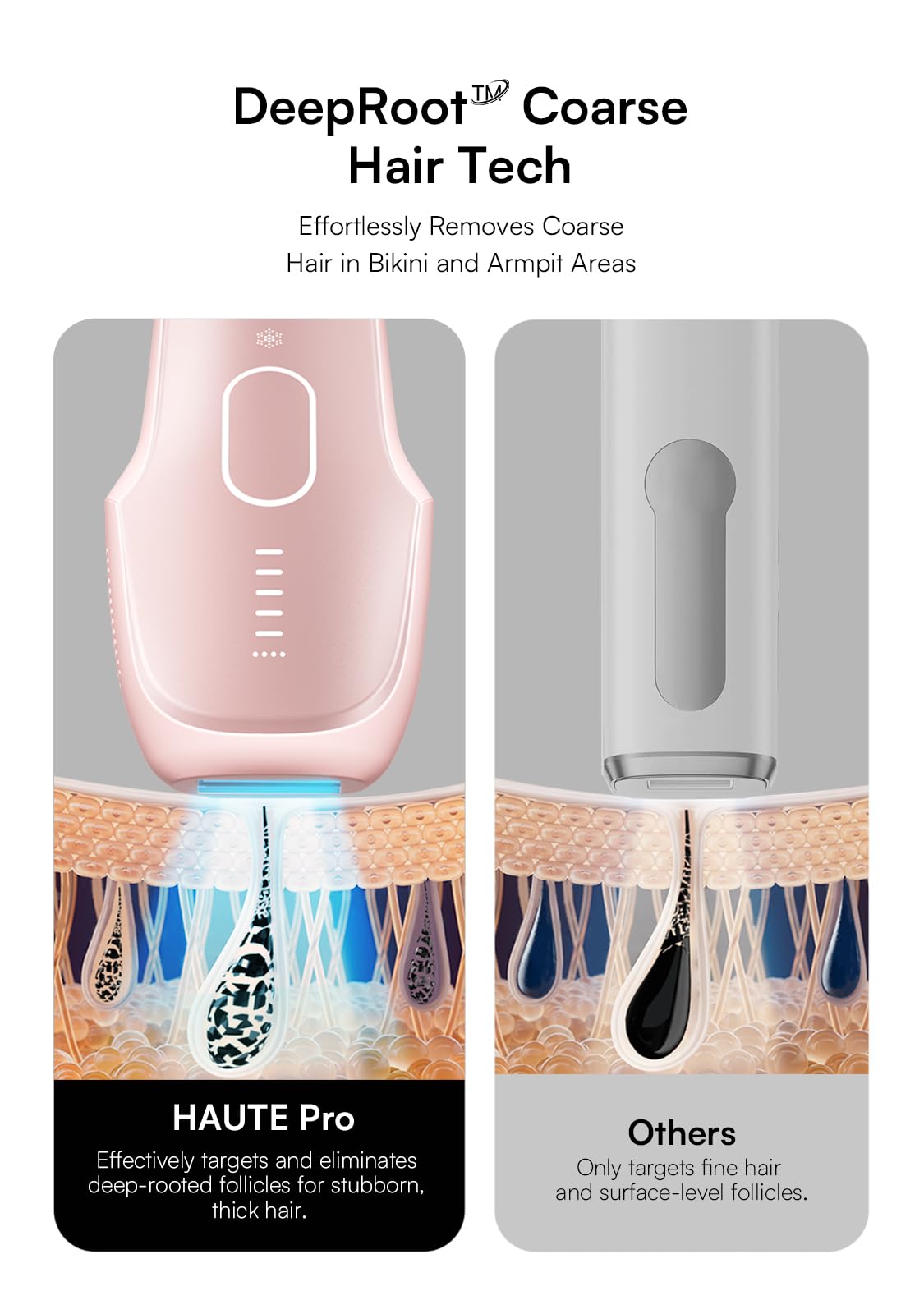 INIA Laser Hair Removal with Ice-Cooling Care for Women and Men, HAUTE Pro Painless at-Home IPL Hair Remover for Coarse Hair in Bikini All Body Areas, Latest Generation for Effective Results (Pink)