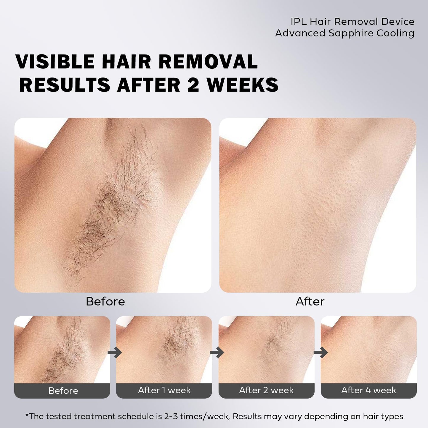 EUARNE Laser Hair Removal for Women and Men, IPL Laser Hair Removal Painless, Permanent, at-Home Use Facial Hair Removal for Women, Dual Lights, Effective in 2 Weeks, Storage Bag for Travel