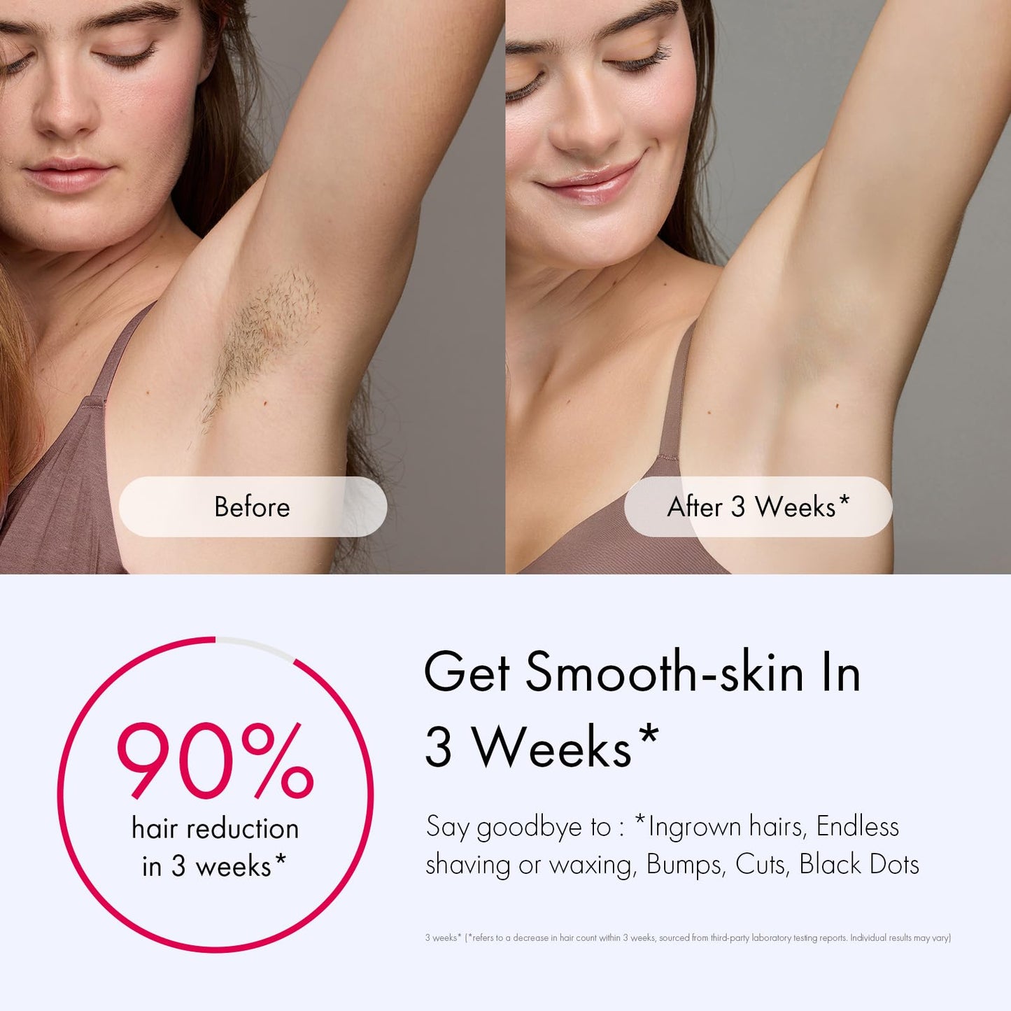 Ulike Laser Hair Removal for Women and Men, Air 3 Ice-Cooling IPL Hair Removal Device for Nearly Painless & Long-Lasting Results, 3 Modes & Auto Flashing for Fast Full Body Hair Removal from Home