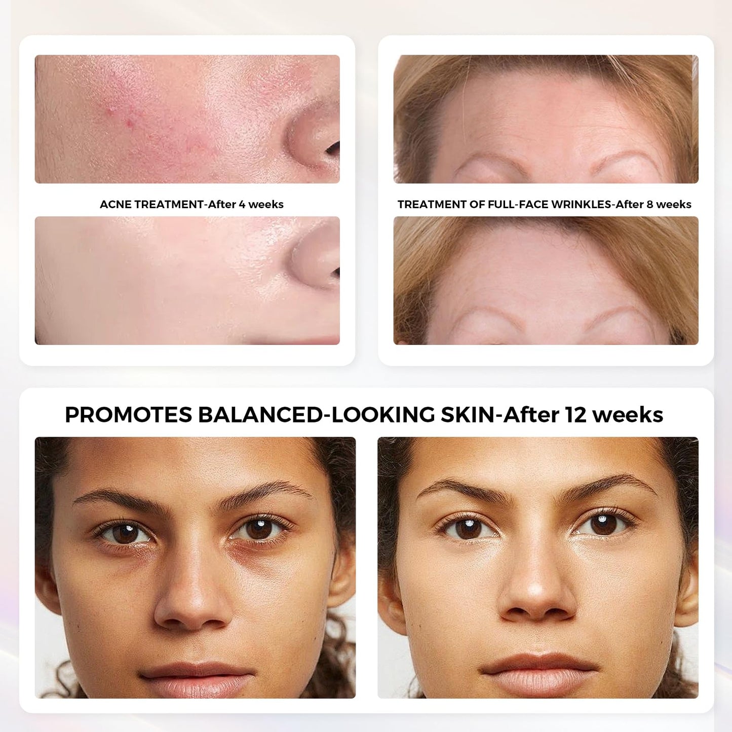 QuasarMD 3D LED Face Mask with Gold-Wire LEDs, Red & Infrared Light for Wrinkles, Blue Light Mode for Blemish Care, Advanced Light Therapy for Skin Rejuvenation & Radiant Look