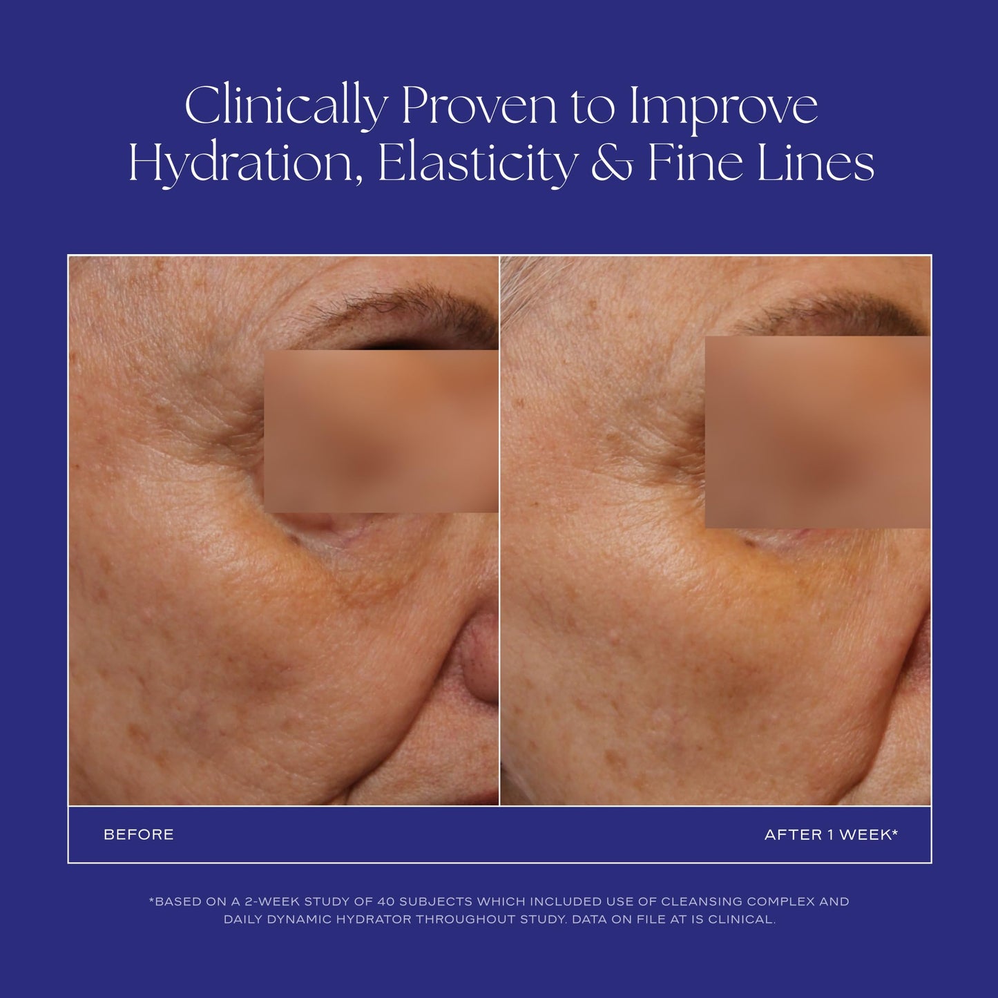 iS CLINICAL Daily Dynamic Hydrator, Hydrating Anti-Aging Face Moisturizer with Hyaluronic Acid, Repairs and Protects Skin, Powered by GeneXC Technology