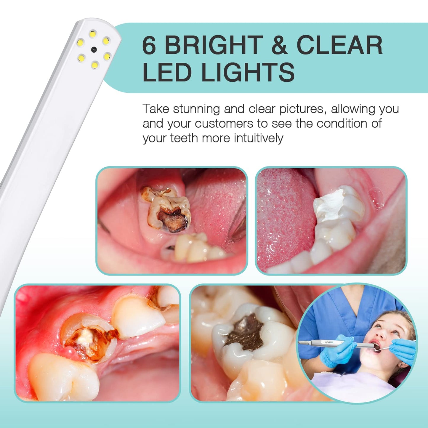 ProDENT Intraoral Camera PD740, Capture Button Driver to Work with Eaglesoft, Dexis, Apeteryx, Carestream, Tigerview,