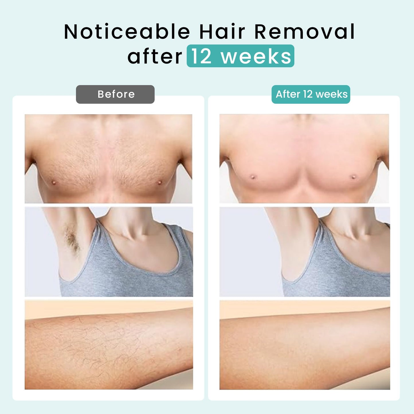 IPL Hair Removal, DermRays Laser Hair Removal, Permanent Reduction in Hair Regrowth for Women and Men, IPL Suitable for Skin Tone 1-5