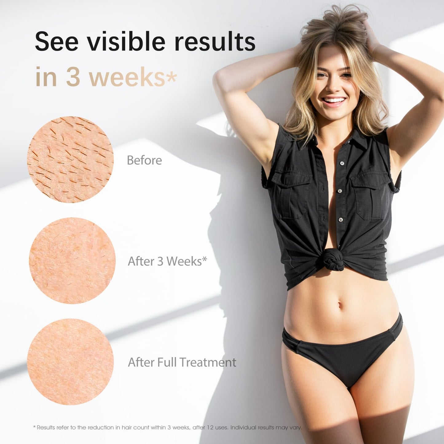 Laser Hair Removal, IPL Hair Removal for Nearly Painless & Long-Lasting Result, Safe At-Home Hair Remover Device for Armpits Back Legs Arms Face Bikini Line, Dark Green