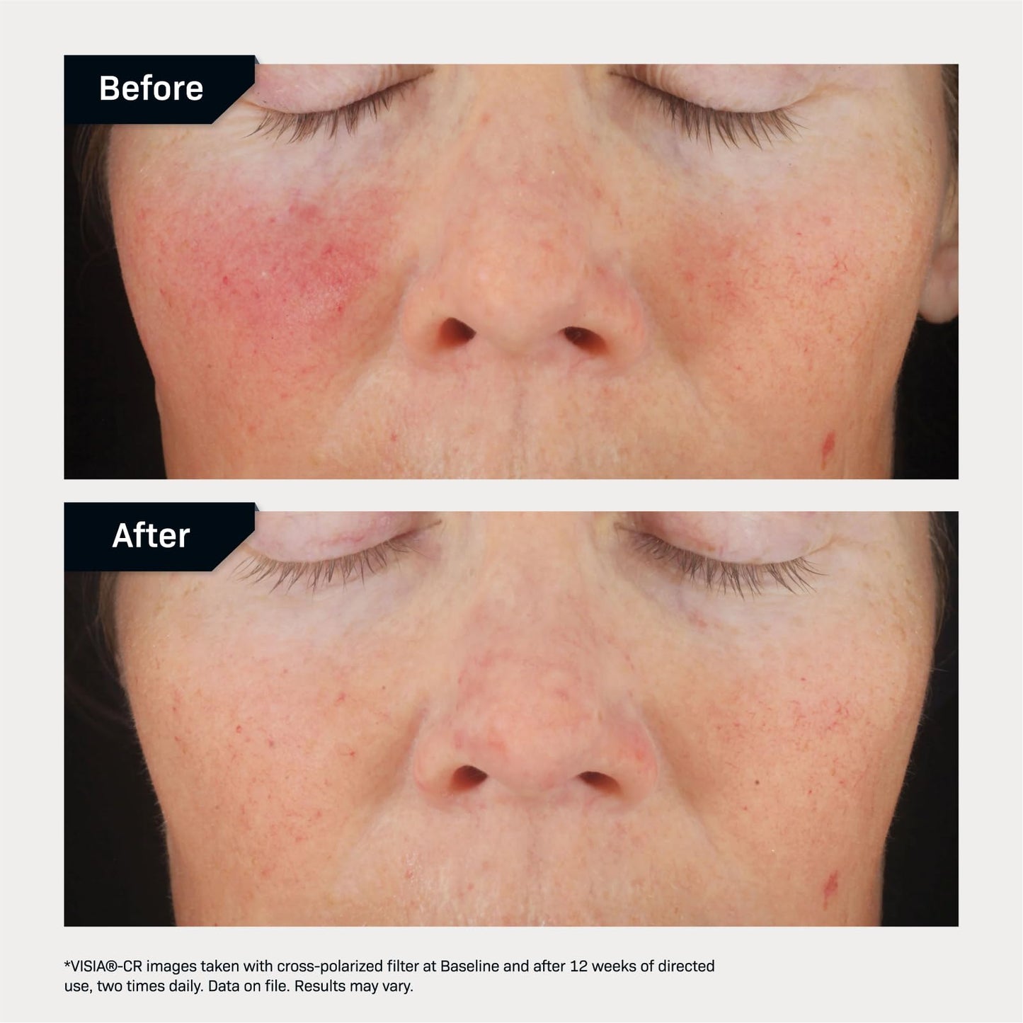 Revision Skincare C+ Correcting Complex 30%®, Anti Aging Antioxidant Blend with Vitamin C, Supports Healthy Skin, 1 fl oz