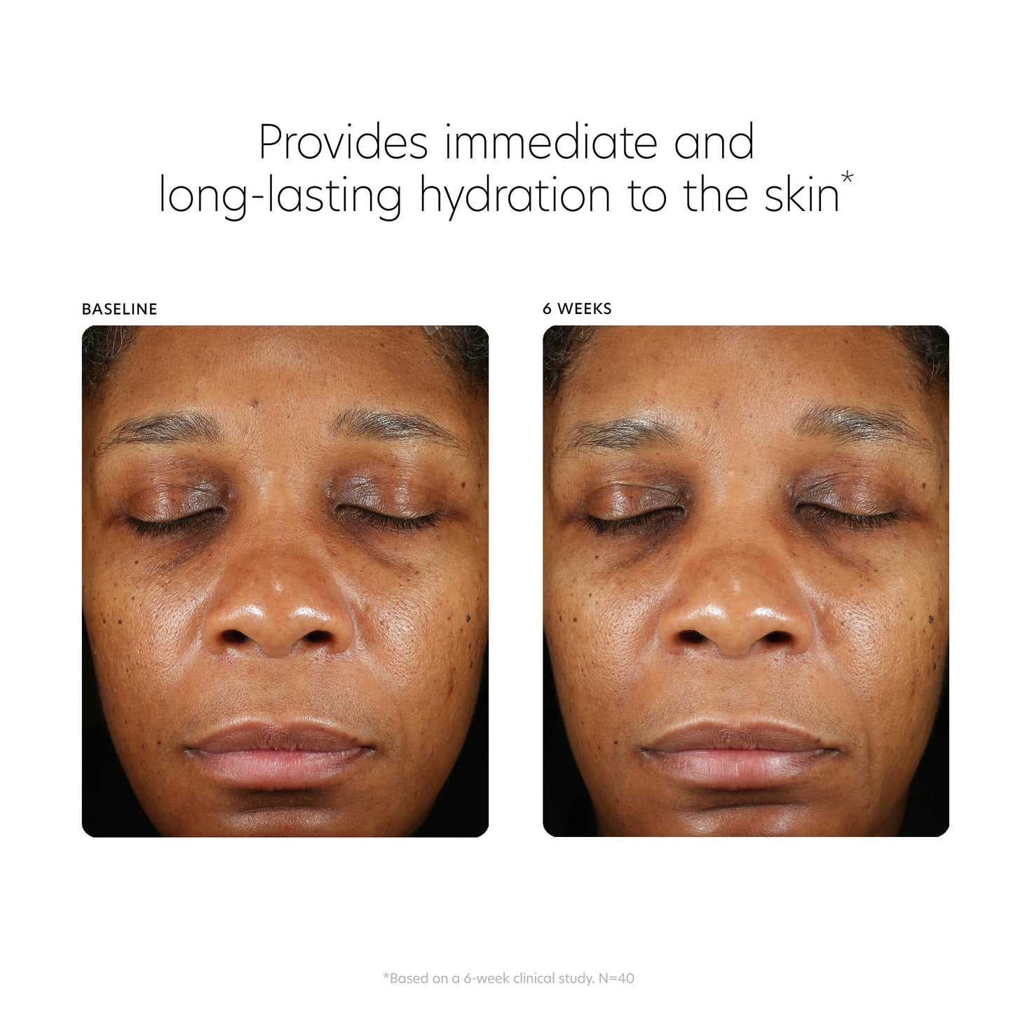 PCA SKIN Hyaluronic Acid Boosting Face Serum - Anti Aging Hydrating Facial Corrector with Niacinamide for Smoothing Wrinkles & Fine Lines (3 fl oz)