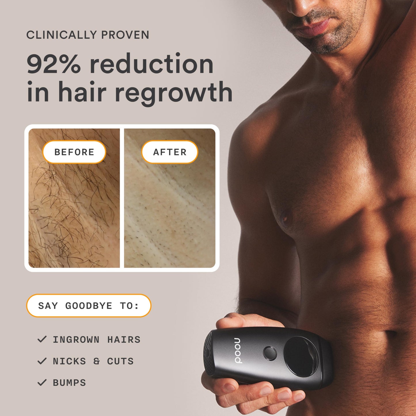 NEW Nood™ Flasher 2.0 + Serum + Shaving Starter Kit — IPL Laser Hair Removal Device for Women & Men with Refillable 5-Blade Razors & After Shave to Prevent Ingrowns & Slow Hair Regrowth — Gloss White