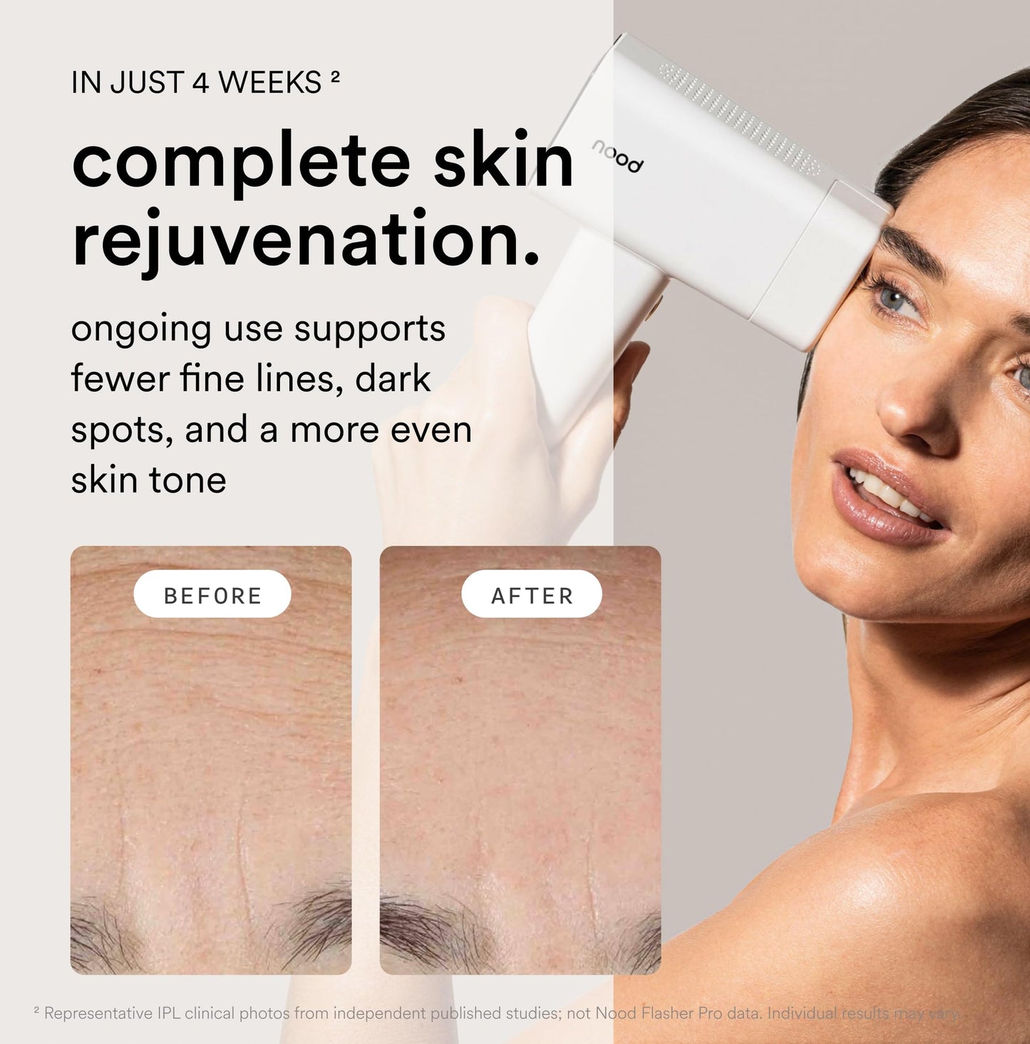 Nood™ NEW Flasher Pro Kit — IPL Laser Hair Removal Device for Women & Men + Refillable 5-Blade Shaving Razor Kit + Exfoliating Buff Bar + Hydrating Shave Lube + After Shave Serum — Gloss White