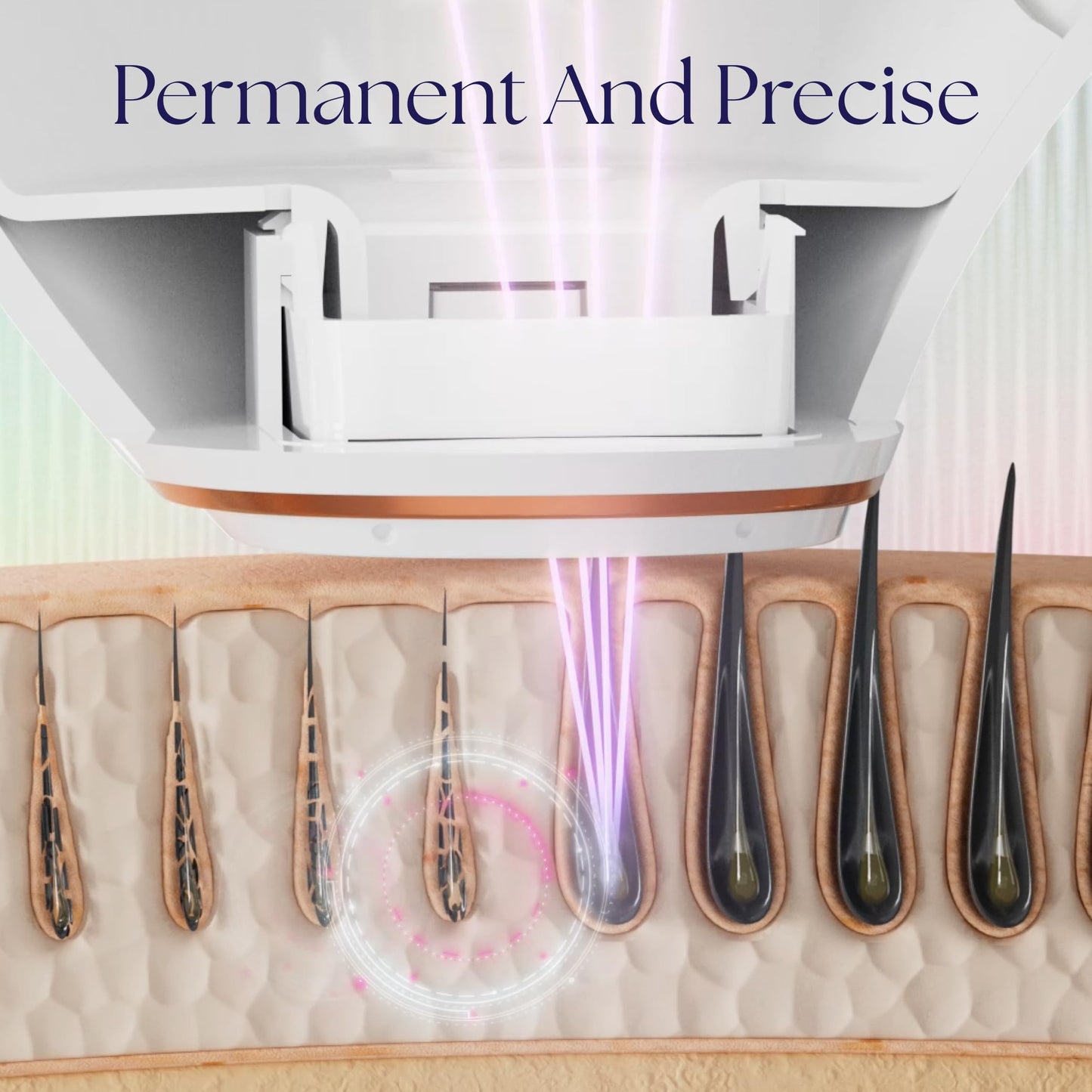 Epilaser At-Home True Laser Hair Removal Device for Light Skin, Safe, Intelligent, Painless and Permanent Hair Removal for Face, Body, Bikini Line