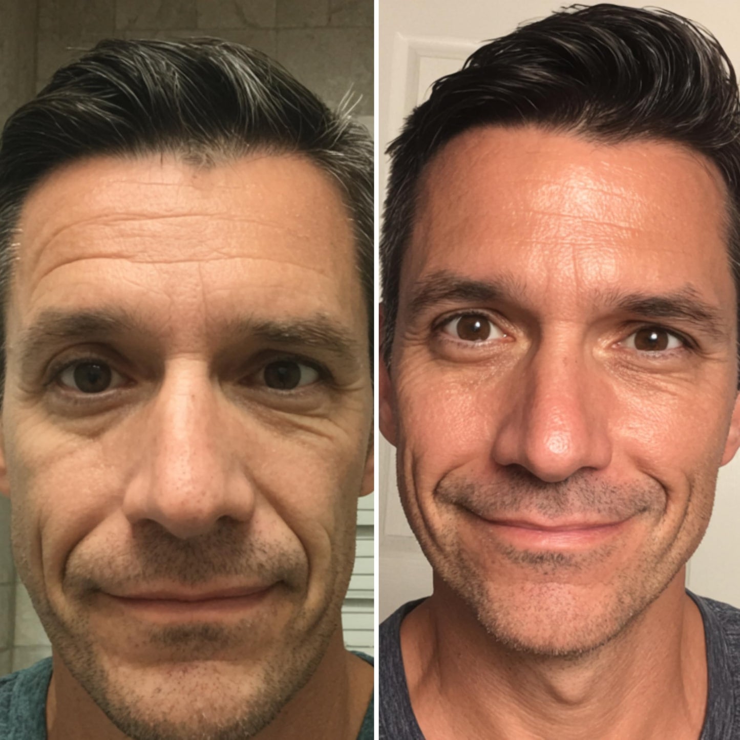LeVaye Strateva RX Advanced Anti-Aging Serum For Men – Vitamin C, Niacinamide, Natural Retinol, Hyaluronic Acid & Peptides – Targets Wrinkles, Fine Lines, Dark Spots, Dark Circles & Enlarged Pores